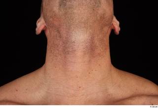 Arnost neck 0001.jpg